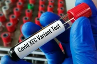 Xét nghiệm biến thể Xec của Covid (Nguồn: Quatidiano.net)