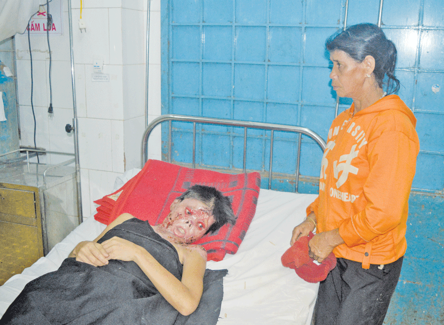 Em Phẽp đang điều trị tại bệnh viện. Ảnh: H.N