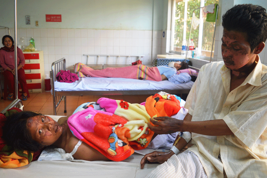 Anh Ksor Thu và chị Rah Lan Sư đang điều trị bỏng ở Bệnh viện Đa khoa tỉnh. Ảnh: Đ.Y Anh Ksor Thu và chị Rah Lan Sư đang điều trị bỏng ở Bệnh viện Đa khoa tỉnh. Ảnh: Đ.Y