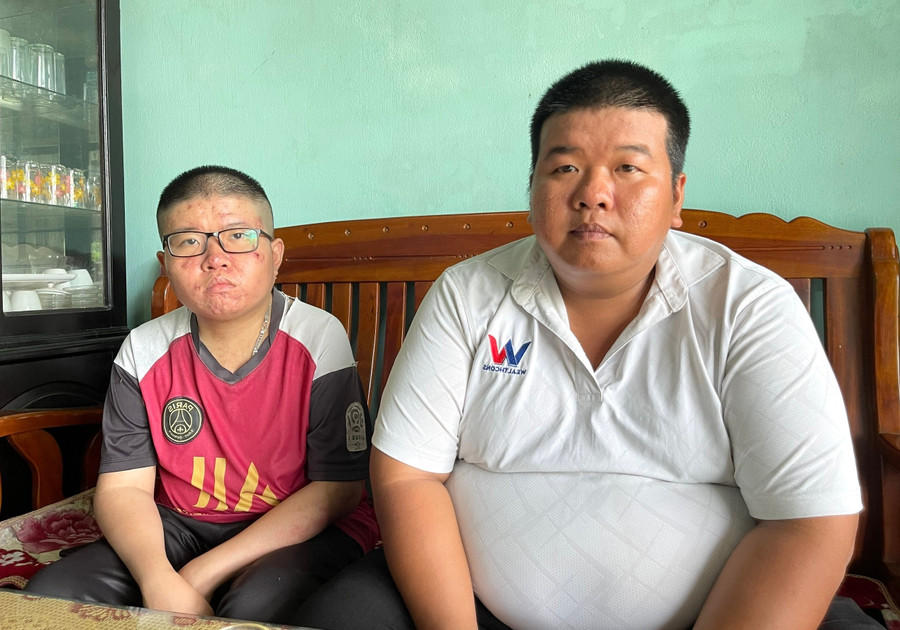 Mồ côi cha mẹ, Nguyên (bên trái ảnh) được anh trai Nguyễn Bình Phương chăm sóc, cổ vũ trên con đường chiến đấu với bệnh tật và tiếp tục nuôi ước mơ chinh phục giảng đường đại học. Ảnh: T.D d7649e4507fb8fa5d6ea.jpg