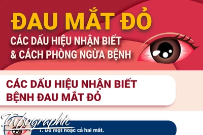 Đau mắt đỏ-Các dấu hiệu nhận biết và cách phòng ngừa bệnh 