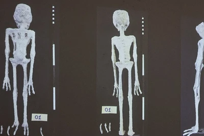 Vén màn bí ẩn xác ướp 'người ngoài hành tinh' ở Peru