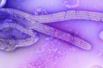 Chuyên gia nói gì về khả năng virus Marburg có tỉ lệ tử vong 70-80% lây sang Việt Nam? 