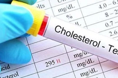 Nghiên cứu mới: 'Cholesterol tốt' không có lợi như người ta tưởng