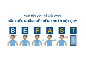 BE FAST - dấu hiệu nhận biết những triệu chứng của bệnh đột quỵ