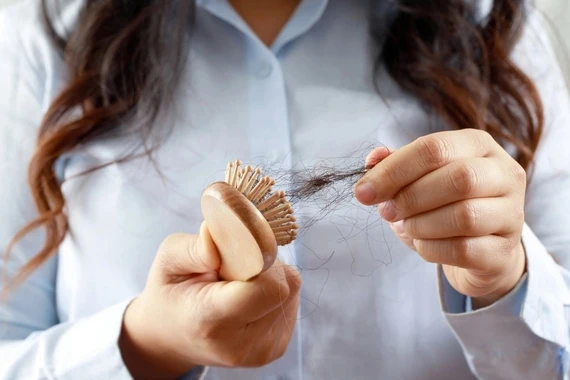 “Thủ phạm” trong ăn uống khiến tóc gãy rụng nhiều