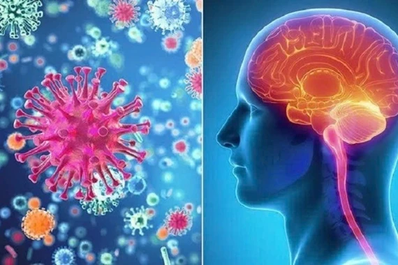 Bộ Y tế yêu cầu triển khai biện pháp phòng - chống bệnh viêm màng não mô cầu