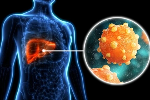 Tin vui cho người mắc viêm gan B