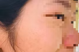 Đắk Nông: Con bị hạnh kiểm trung bình, phụ huynh đến nhà đánh cô giáo