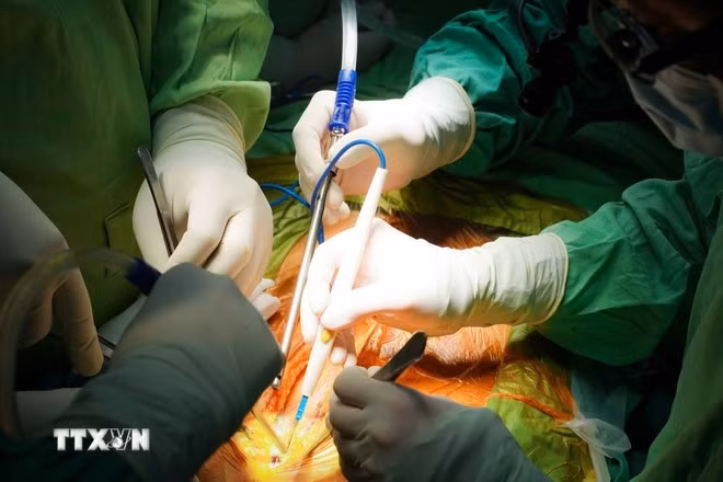 Các bác sỹ Bệnh viện Chợ Rẫy tiến hành lấy tạng của người hiến chết não. Ảnh: TTXVN phát