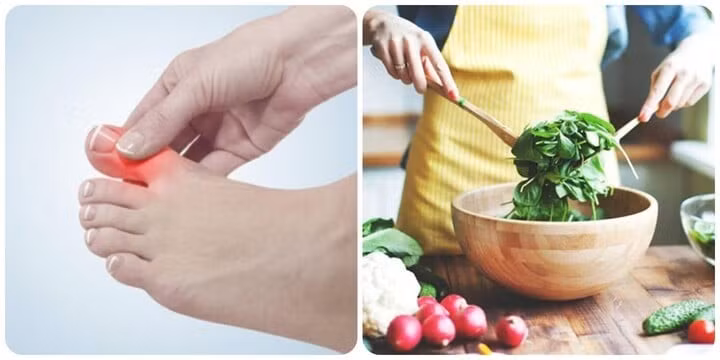 Người có nồng độ axit uric cao nên có chế độ ăn uống lành mạnh