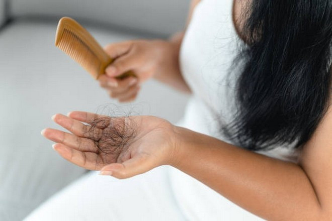 Thiếu protein là một trong những nguyên nhân phổ biến gây rụng tóc. (Ảnh: iStock) Thiếu protein là một trong những nguyên nhân phổ biến gây rụng tóc. (Ảnh: iStock)