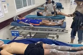 4 học sinh bị bỏng nặng do tự chế pháo nổ theo Youtube