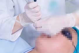 Thực hư chữa hết ngáy ngủ qua một lần điều trị