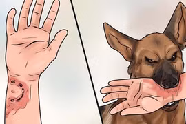 Người đàn ông qua đời sau 2 tháng bị mèo cắn