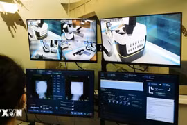 Bệnh viện đầu tiên ở Việt Nam có hệ thống robot xạ phẫu tích hợp AI chữa ung thư