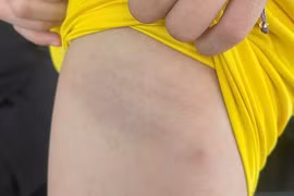 Xác minh thông tin nhiều học sinh bị cô giáo hành hạ