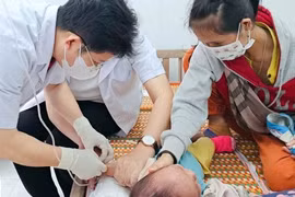 Hai trẻ tử vong, nhiều người sốt cao, phát ban, Bộ Y tế nói gì?