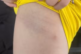 Phạt hành chính, tạm dừng giảng dạy đối với giáo viên dùng dây điện đánh học sinh