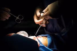 Phẫu thuật sứt môi, hở hàm ếch miễn phí cho trẻ em