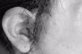 Pleiku: Một phụ nữ biến chứng nghiêm trọng sau phẫu thuật căng da mặt tại spa