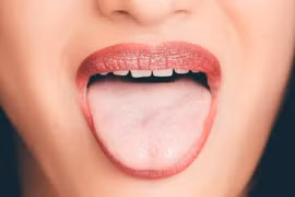 Ung thư: Những bất thường dưới lưỡi không được chủ quan