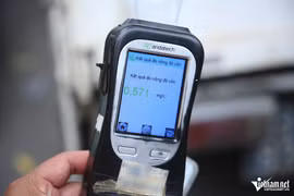 Đề nghị bỏ xét nghiệm nồng độ cồn người đi khám sức khỏe thi bằng lái xe