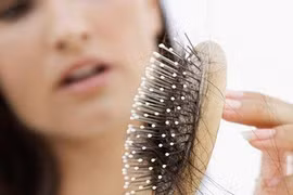 Làm thế nào để tránh rụng tóc nhiều trong mùa đông?
