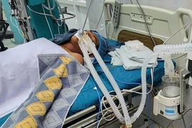 Bệnh nhân nhập viện trong tình trạng nguy kịch vì nhiễm Leptospira. Ảnh: ĐVCC