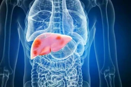 Cách phục hồi gan sau rượu bia ngày Tết Nguyên đán