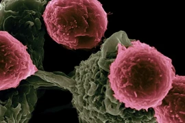 Australia phát triển liệu pháp miễn dịch mới cho ung thư máu hiếm gặp