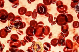 Biến thể gene hiếm chống ung thư máu mở ra hướng điều trị mới