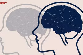 Phát triển công nghệ giải mã 'độc thoại nội tâm,' biến suy nghĩ thành lời nói