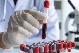 Đột phá xét nghiệm máu giúp ngừa đau tim