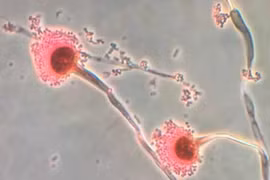 Báo động về nguy cơ phát tán một loại nấm có khả năng 'ăn thịt con người' từ bên trong