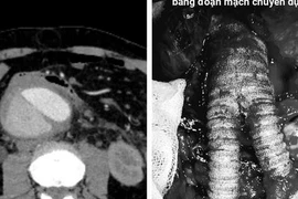Du khách nước ngoài nguy kịch, bác sĩ Việt cứu sống ngoạn mục