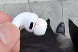 AirPods Pro 3 gặp sự cố gây chảy máu tai