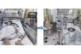 Bé gái mắc căn bệnh hiếm chỉ 0,1% dân số thế giới mới gặp