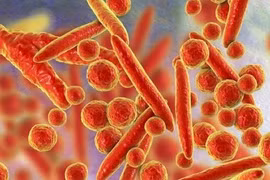 Vi khuẩn liên quan bệnh hô hấp ở Nga từng ghi nhận tại Việt Nam