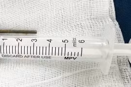 Bé trai 6 tuổi ở Quảng Ngãi thoát nguy hiểm nhờ được gắp đinh sắt trong bụng