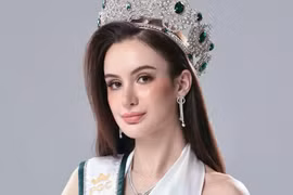 Hoa hậu Hòa bình Canada tiết lộ từng sang Việt Nam 'dao kéo'
