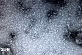 Phát hiện sự liên quan giữa COVID-19 và hoại tử xương