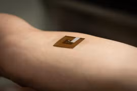 Độc đáo miếng dán phát hiện ung thư da