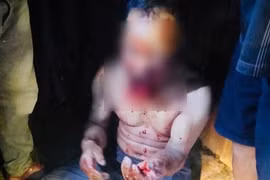 Một trưởng thôn ở Đà Nẵng bị gấu rừng tấn công