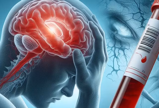 Xét nghiệm máu mới giúp dự đoán mức rủi ro đột quỵ của một người - Ảnh đồ họa AI
