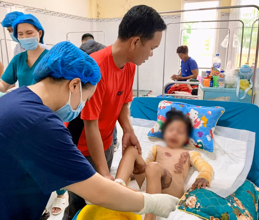 Tai nạn thương tích ở trẻ em có chiều hướng gia tăng trong những ngày vừa qua. Ảnh: Như Nguyện