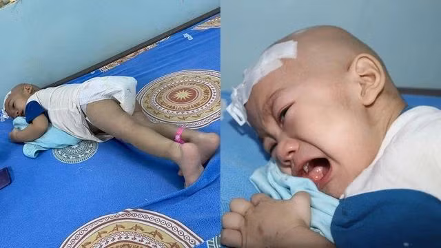 Tư thế nằm "chữa cơn đau" của Phát