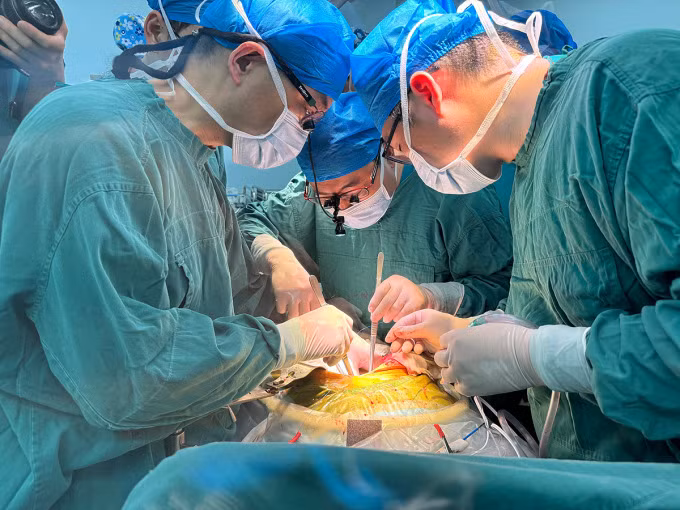 Các bác sĩ phẫu thuật ghép gan lợn cho bệnh nhân ngày 17-5. Ảnh: Bệnh viện Đại học Y An Huy