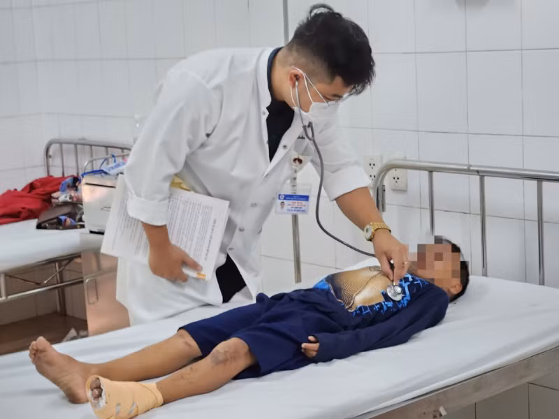 Một bệnh nhi bị bỏng nặng do đốt pháo được chăm sóc, điều trị tại Bệnh viện Trung ương Huế