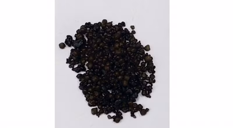Hơn 400 viên sỏi trong túi mật của bệnh nhân S. được ê-kip bác sĩ phẫu thuật lấy ra thành công.